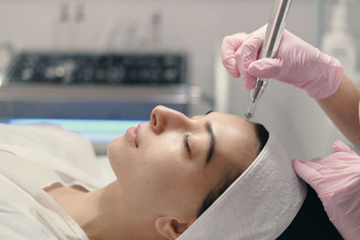 Tratamiento de mesoterapia facial con dermapen
