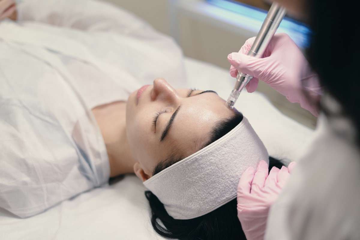 Tratamiento de mesoterapia facial con dermapen